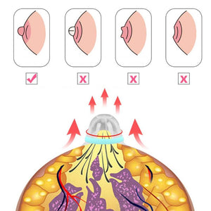 Nipple Corrector for Flat Inverted Nipples